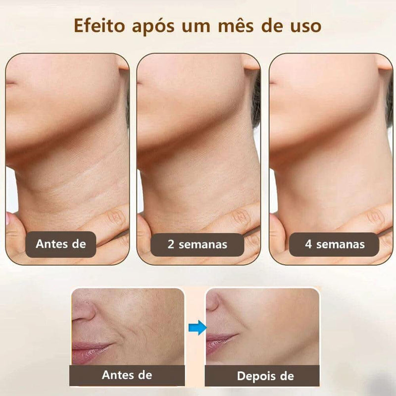 Neoskin | Rejuvenescimento e Autoestima - Neoprime