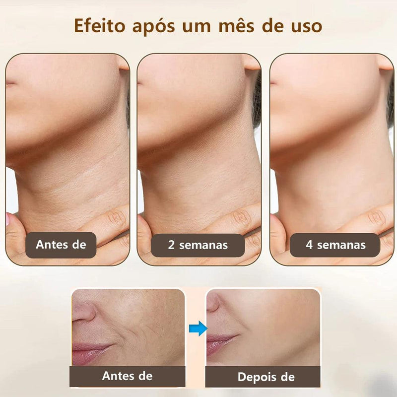 Neoskin |  Rejuvenescimento e Autoestima